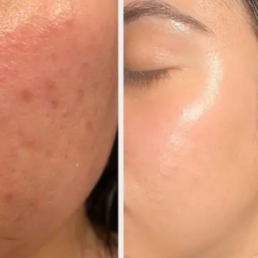 صابون گلوتاتیون